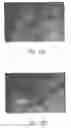 Fig. 38 - ANTI-ANGIOGENIC COMPOSITIONS AND METHODS OF USE