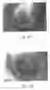 Fig. 76 - ANTI-ANGIOGENIC COMPOSITIONS AND METHODS OF USE