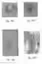 Fig. 77 - ANTI-ANGIOGENIC COMPOSITIONS AND METHODS OF USE