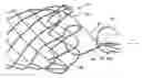 Fig. 01 - INTEGRATED STENT RETRIEVAL LOOP ADAPTED FOR SNARE REMOVAL AND/OR OPTIMIZED PURSE STRINGING