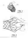 Fig. 02 - INTEGRATED STENT RETRIEVAL LOOP ADAPTED FOR SNARE REMOVAL AND/OR OPTIMIZED PURSE STRINGING