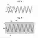 Fig. 04 - STENT - GRAFT SUTURE LOCKS