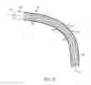 Fig. 04 - Stent with constant stiffness along the length of the stent