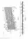 Fig. 02 - Methods for forming an orthogonal end on a helical stent