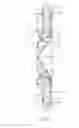 Fig. 05 - Methods for deploying a prosthesis