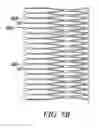 Fig. 08 - Methods for deploying a prosthesis
