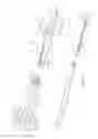 Fig. 12 - Methods for deploying a prosthesis