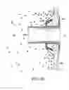 Fig. 31 - Methods for deploying a prosthesis