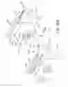 Fig. 38 - Methods for deploying a prosthesis