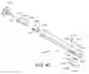 Fig. 41 - Methods for deploying a prosthesis