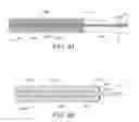 Fig. 43 - Methods for deploying a prosthesis