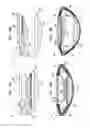 Fig. 03 - ACCOMMODATIVE INTRAOCULAR LENS