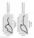 Fig. 09 - MODULUS-MATCHING GRAFT