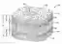 Fig. 01 - Composite implant
