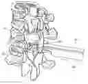 Fig. 01 - SYSTEM AND METHODS FOR INSERTING A VERTEBRAL SPACER
