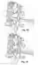 Fig. 13 - SYSTEM AND METHODS FOR INSERTING A VERTEBRAL SPACER