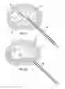 Fig. 14 - Method and device for treatment of the spine