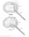 Fig. 15 - Method and device for treatment of the spine
