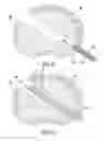 Fig. 20 - Method and device for treatment of the spine