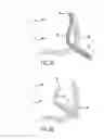 Fig. 22 - Method and device for treatment of the spine