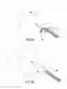 Fig. 23 - Method and device for treatment of the spine
