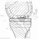 Fig. 01 - Articular surface implant and delivery system