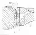 Fig. 07 - Articular surface implant and delivery system