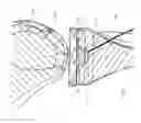 Fig. 08 - Articular surface implant and delivery system