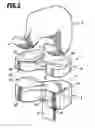Fig. 02 - Knee endoprosthesis