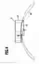 Fig. 05 - Knee endoprosthesis