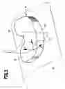 Fig. 06 - Knee endoprosthesis