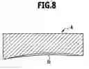 Fig. 09 - Knee endoprosthesis