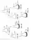 Fig. 06 - Patient-adapted and improved articular implants, designs and related guide tools