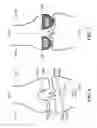 Fig. 07 - Patient-adapted and improved articular implants, designs and related guide tools