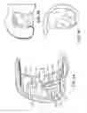 Fig. 08 - Patient-adapted and improved articular implants, designs and related guide tools