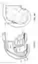 Fig. 09 - Patient-adapted and improved articular implants, designs and related guide tools