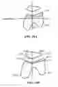 Fig. 10 - Patient-adapted and improved articular implants, designs and related guide tools