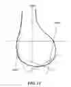 Fig. 11 - Patient-adapted and improved articular implants, designs and related guide tools