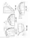 Fig. 14 - Patient-adapted and improved articular implants, designs and related guide tools