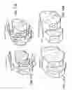 Fig. 16 - Patient-adapted and improved articular implants, designs and related guide tools