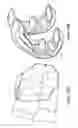 Fig. 17 - Patient-adapted and improved articular implants, designs and related guide tools