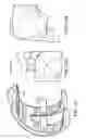 Fig. 19 - Patient-adapted and improved articular implants, designs and related guide tools
