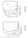 Fig. 21 - Patient-adapted and improved articular implants, designs and related guide tools