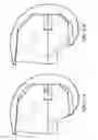 Fig. 23 - Patient-adapted and improved articular implants, designs and related guide tools