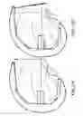 Fig. 24 - Patient-adapted and improved articular implants, designs and related guide tools