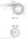 Fig. 03 - Tissue interface for implantable restriction system