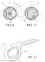 Fig. 05 - Tissue interface for implantable restriction system