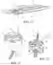 Fig. 09 - Tissue interface for implantable restriction system