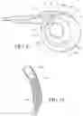 Fig. 13 - Tissue interface for implantable restriction system