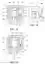 Fig. 16 - Tissue interface for implantable restriction system